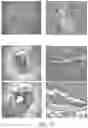 Fig. 13 - DEVICES AND METHODS FOR TREATING A FISTULA