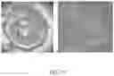 Fig. 14 - DEVICES AND METHODS FOR TREATING A FISTULA