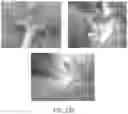 Fig. 15 - DEVICES AND METHODS FOR TREATING A FISTULA