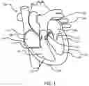 Fig. 02 - Reversible Electroporation for Cardiac Defibrillation