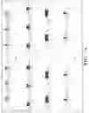Fig. 02 - BREATHING RHYTHM RESTORATION SYSTEMS, APPARATUSES, AND INTERFACES AND METHODS FOR MAKING AND USING SAME
