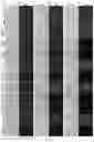 Fig. 07 - GENE INTERFERENCE VECTOR- AND IRON NANOPARTICLE-BASED COMPOSITION FOR KILLING CANCER CELLS, AND USE THEREOF
