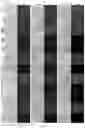 Fig. 08 - GENE INTERFERENCE VECTOR- AND IRON NANOPARTICLE-BASED COMPOSITION FOR KILLING CANCER CELLS, AND USE THEREOF