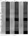 Fig. 22 - GENE INTERFERENCE VECTOR- AND IRON NANOPARTICLE-BASED COMPOSITION FOR KILLING CANCER CELLS, AND USE THEREOF