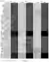 Fig. 35 - GENE INTERFERENCE VECTOR- AND IRON NANOPARTICLE-BASED COMPOSITION FOR KILLING CANCER CELLS, AND USE THEREOF
