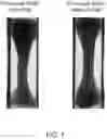 Fig. 02 - ARTIFICIAL SKELETAL MUSCLE TISSUE
