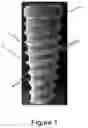 Fig. 02 - DENTAL IMPLANT