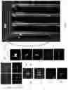 Fig. 30 - Systems, methods, and devices for medical image analysis, diagnosis, risk stratification, decision making and/or disease tracking