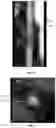 Fig. 32 - Systems, methods, and devices for medical image analysis, diagnosis, risk stratification, decision making and/or disease tracking