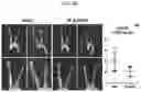 Fig. 12 - COMPOSITION FOR PREVENTING OR TREATING CARDIOVASCULAR AND METABOLIC DISEASES COMPRISING ELAEOCARPUS PETIOLATUS