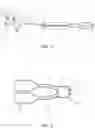 Fig. 02 - DEVICES AND METHODS FOR TREATING BRANCHING BLOOD VESSELS
