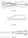 Fig. 03 - DEVICES AND METHODS FOR TREATING BRANCHING BLOOD VESSELS