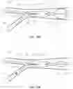 Fig. 09 - DEVICES AND METHODS FOR TREATING BRANCHING BLOOD VESSELS