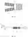Fig. 11 - DEVICES AND METHODS FOR TREATING BRANCHING BLOOD VESSELS