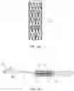 Fig. 13 - DEVICES AND METHODS FOR TREATING BRANCHING BLOOD VESSELS