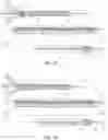 Fig. 16 - DEVICES AND METHODS FOR TREATING BRANCHING BLOOD VESSELS