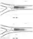 Fig. 23 - DEVICES AND METHODS FOR TREATING BRANCHING BLOOD VESSELS