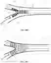 Fig. 24 - DEVICES AND METHODS FOR TREATING BRANCHING BLOOD VESSELS