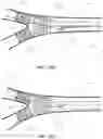 Fig. 25 - DEVICES AND METHODS FOR TREATING BRANCHING BLOOD VESSELS