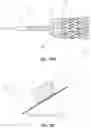 Fig. 29 - DEVICES AND METHODS FOR TREATING BRANCHING BLOOD VESSELS