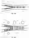 Fig. 41 - DEVICES AND METHODS FOR TREATING BRANCHING BLOOD VESSELS