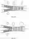 Fig. 45 - DEVICES AND METHODS FOR TREATING BRANCHING BLOOD VESSELS