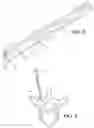 Fig. 07 - Surgical drilling system for determining bone breakthrough