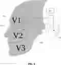 Fig. 02 - Methods and apparatuses for reducing bleeding via coordinated trigeminal and vagal nerve stimulation
