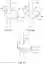 Fig. 07 - PROSTHETIC HEART VALVES WITH EXPANSION AND LOCKING ASSEMBLIES