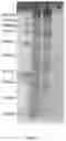 Fig. 02 - VERTICAL PLUG-FLOW PROCESS FOR BIO-CONVERSION OF BIOMASS INVOLVING ENZYMES
