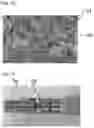 Fig. 06 - DEVICE FOR FIXING AND POSITIONING A CARDIAC PUMP