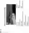 Fig. 20 - SYSTEMS, METHODS, AND DEVICES FOR MEDICAL IMAGE ANALYSIS, DIAGNOSIS, RISK STRATIFICATION, DECISION MAKING AND/OR DISEASE TRACKING