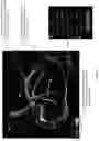 Fig. 24 - SYSTEMS, METHODS, AND DEVICES FOR MEDICAL IMAGE ANALYSIS, DIAGNOSIS, RISK STRATIFICATION, DECISION MAKING AND/OR DISEASE TRACKING