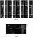 Fig. 34 - SYSTEMS, METHODS, AND DEVICES FOR MEDICAL IMAGE ANALYSIS, DIAGNOSIS, RISK STRATIFICATION, DECISION MAKING AND/OR DISEASE TRACKING