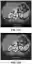 Fig. 59 - SYSTEMS, METHODS, AND DEVICES FOR MEDICAL IMAGE ANALYSIS, DIAGNOSIS, RISK STRATIFICATION, DECISION MAKING AND/OR DISEASE TRACKING
