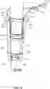 Fig. 02 - Knee Distractor Apparatus and Method