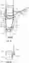 Fig. 03 - Knee Distractor Apparatus and Method