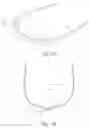 Fig. 02 - Orthodontic Arch Wires & Methods of Use for Prevention of Flaring of Anterior Teeth During Alignment
