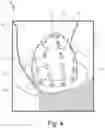 Fig. 04 - Integrally formed flow distributor for fluid manifold