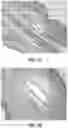 Fig. 06 - PLASMID COMBINATION AND APPLICATION THEREOF IN PREPARING MODIFIED IMMUNE CELLS