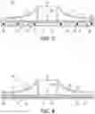 Fig. 06 - Patch for Use with an Injector Device