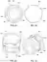 Fig. 08 - DISINFECTING CAP