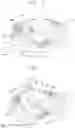 Fig. 02 - Robot cleaner with ascending/descending guides