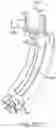 Fig. 366 - Infusion pump assembly