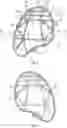 Fig. 02 - Articulated cushioning article with tensile component and method of manufacturing a cushioning article