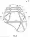 Fig. 06 - Articulated cushioning article with tensile component and method of manufacturing a cushioning article