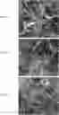 Fig. 03 - Multi-wall carbon nanotubes catalyst synthesis and use thereof