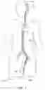Fig. 02 - System and methods for embolized occlusion of neurovascular aneurysms