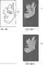 Fig. 10 - IMAGE REGISTRATION WITH APPLICATION IN TISSUE TREATMENT