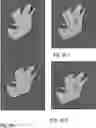 Fig. 11 - IMAGE REGISTRATION WITH APPLICATION IN TISSUE TREATMENT
